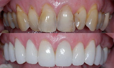 odontoiatria_estetica_studiodentisticopalmarini