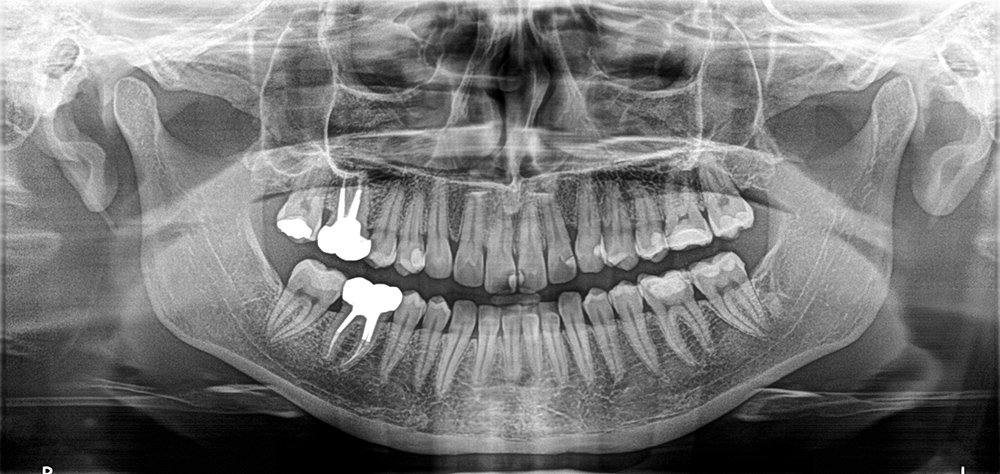 radiologia_digitale_studiodentisticopalmarini